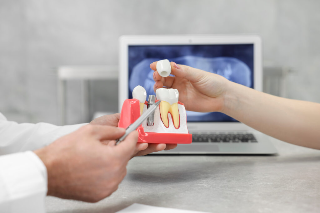brooklyn dental implants