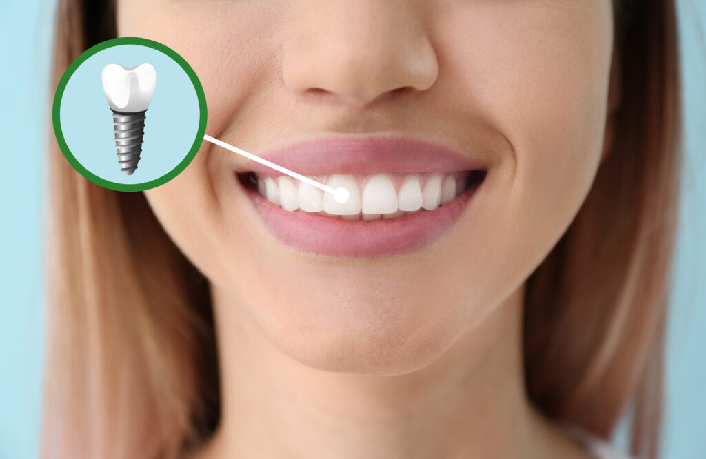 brooklyn dental implant technology