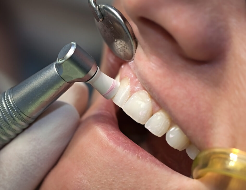 brooklyn perio hygiene services