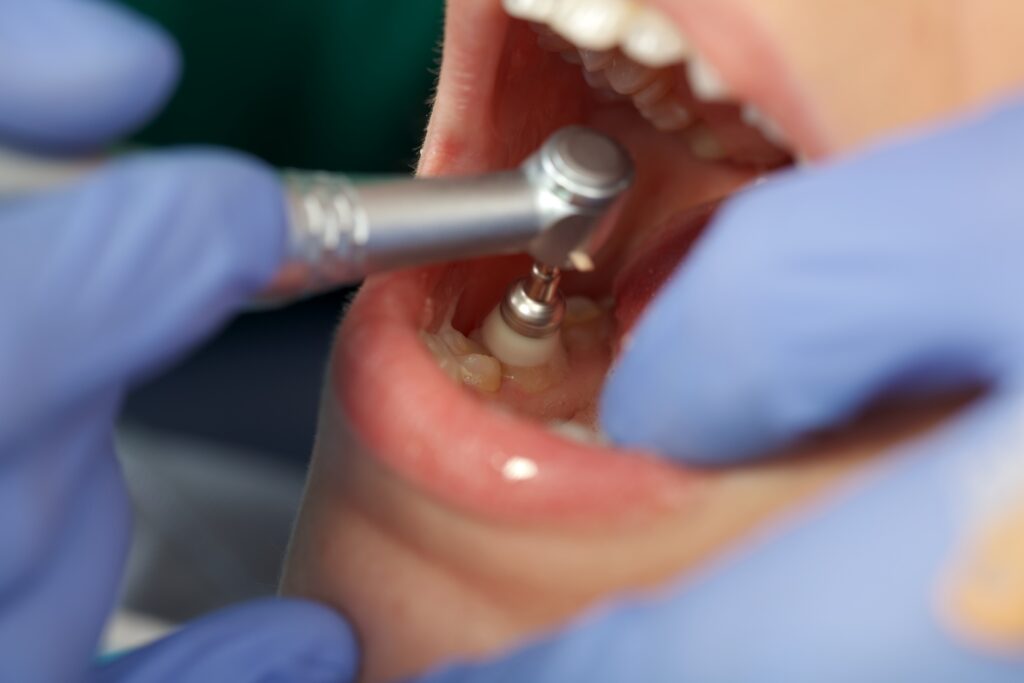 brooklyn dental cleanings