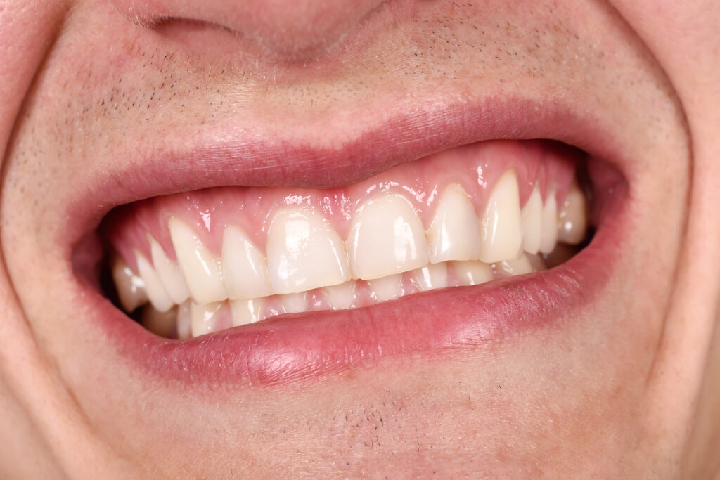 brooklyn periodontic treatment