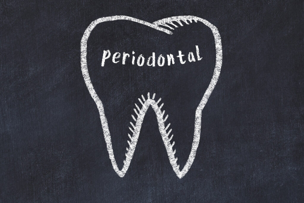 brooklyn periodontic lasers