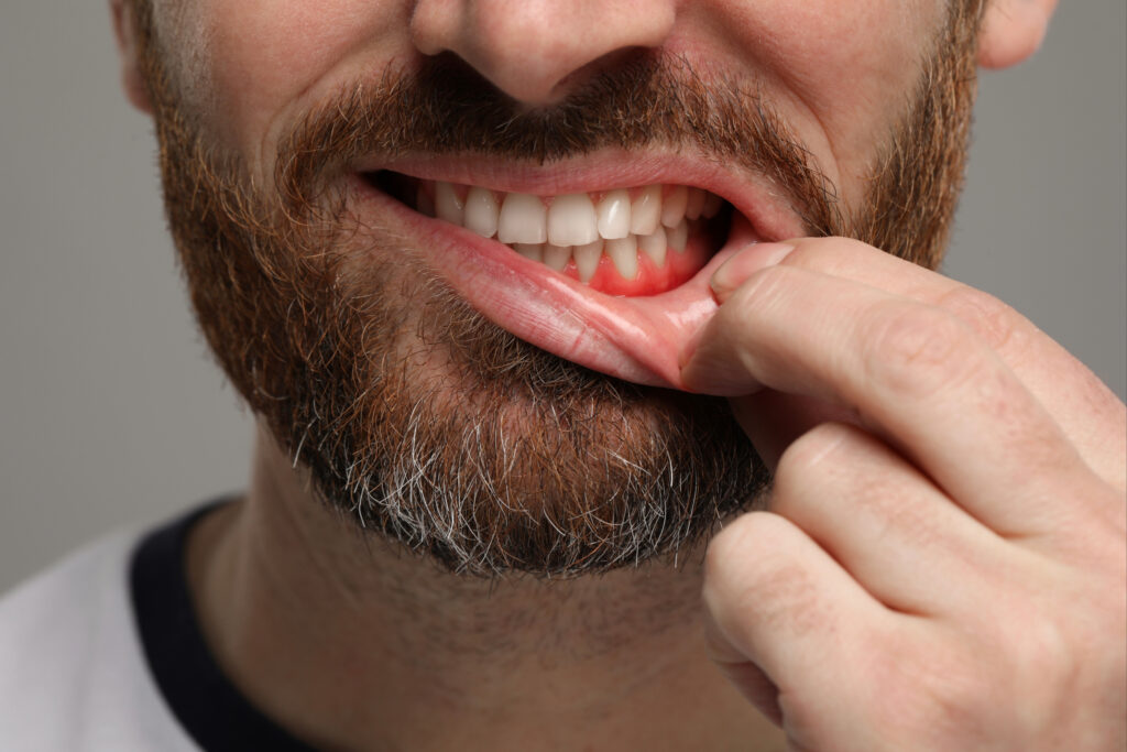 brooklyn perio gum relief