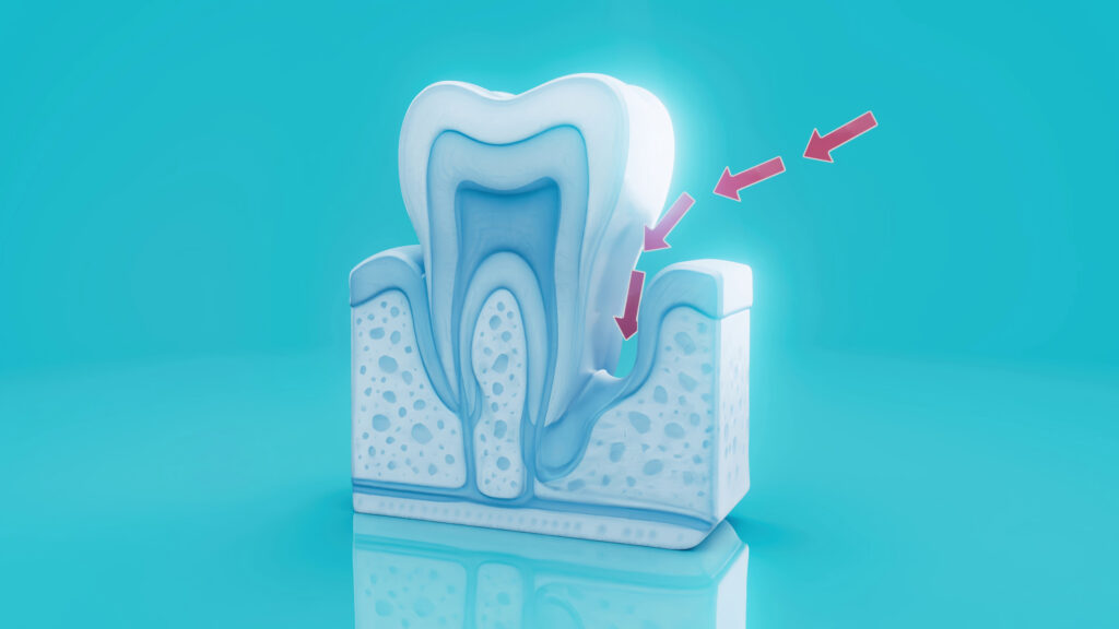 brooklyn perio gum disease