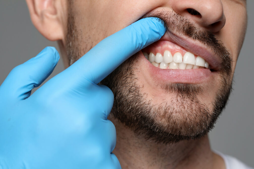 brooklyn periodontic care