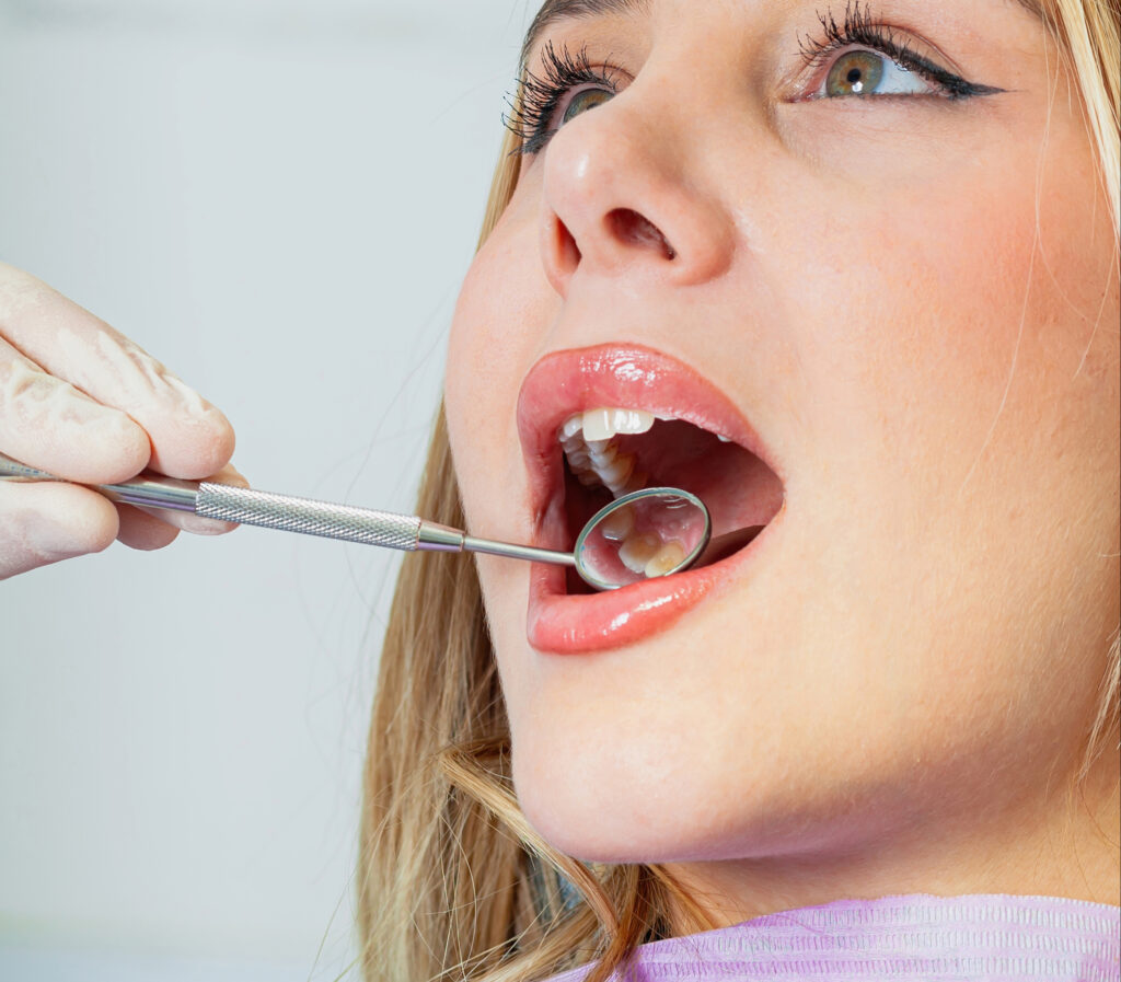 brooklyn perio gum disease