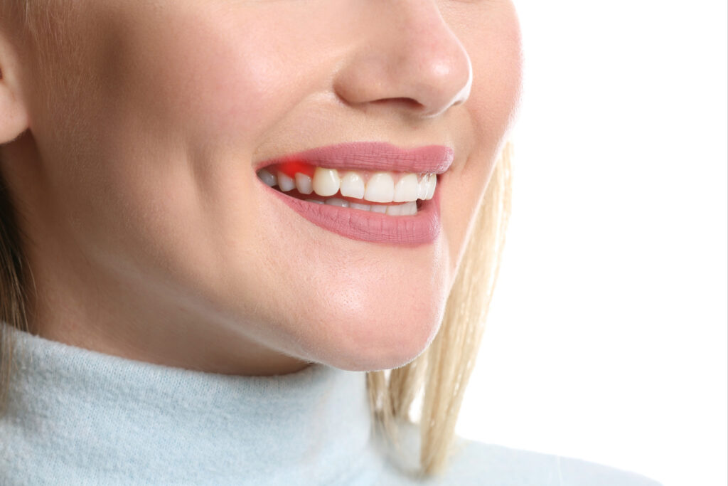 brooklyn perio periodontal disease