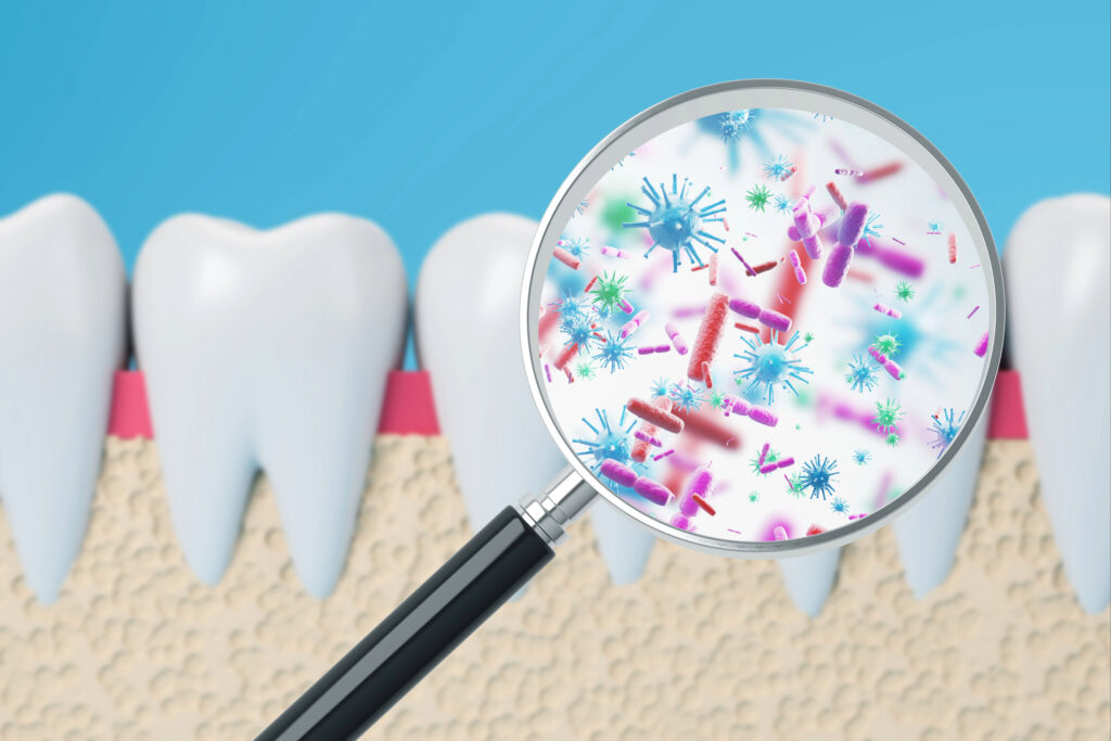 brooklyn perio gum disease