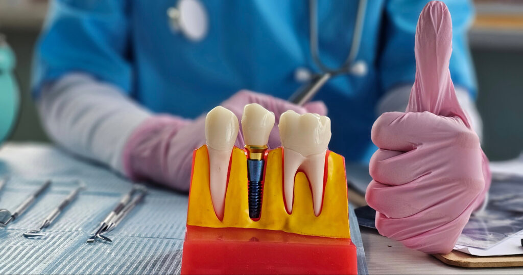 brooklyn perio implant and crown
