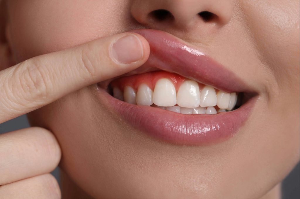 brooklyn perio gum disease