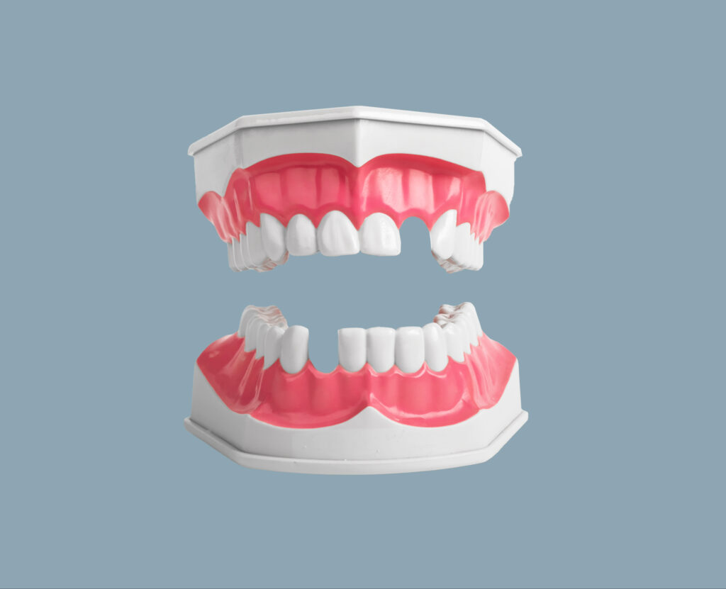 brooklyn perio gum disease